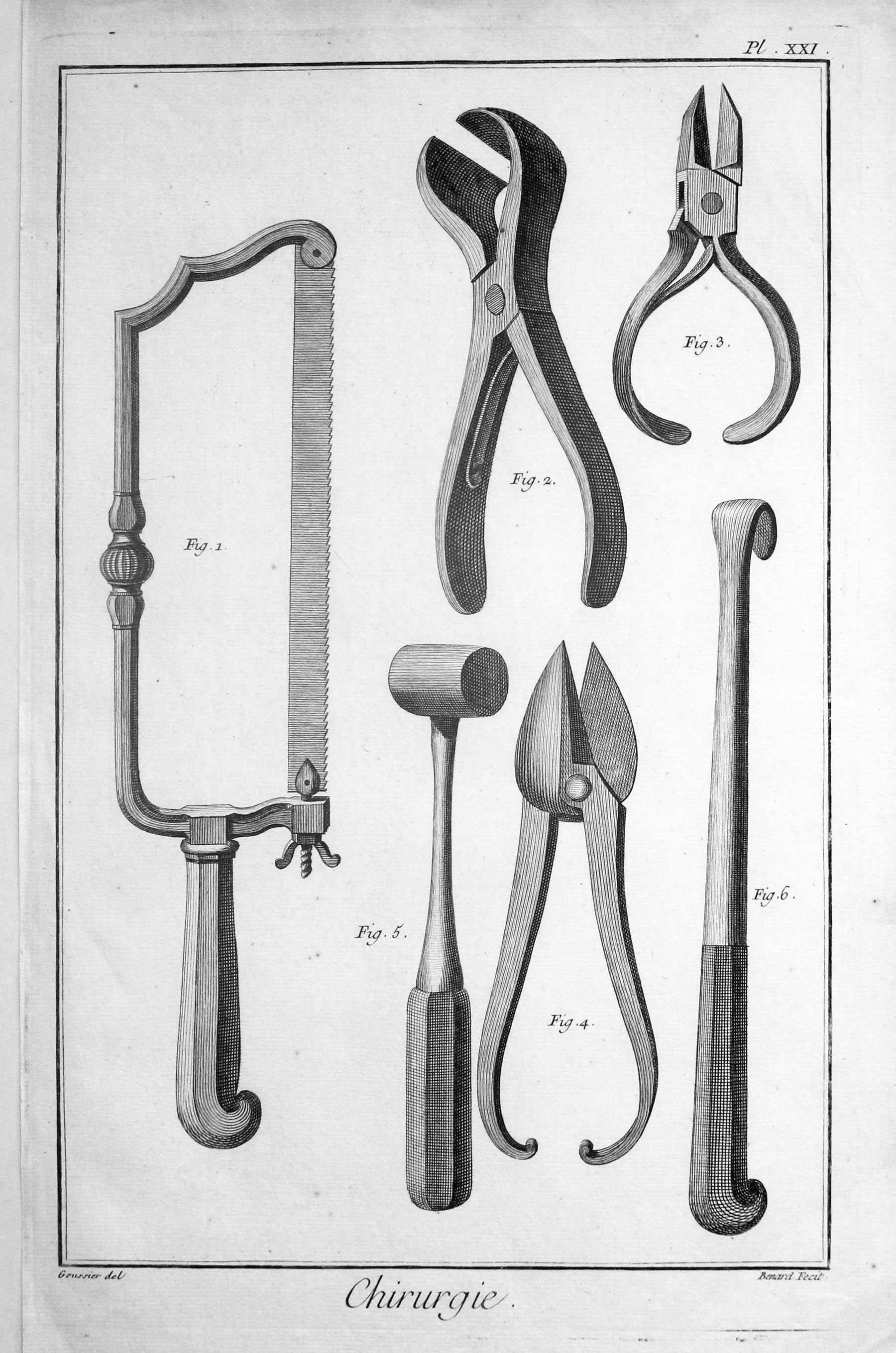 Surgical Instrumensts by Denis Diderot